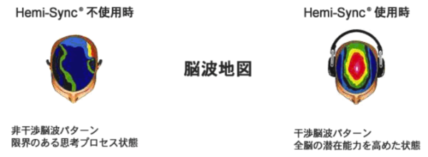 脳波地図